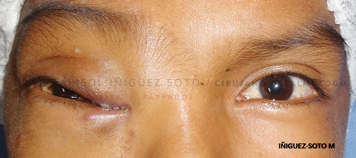 Lucian Portfolio Img